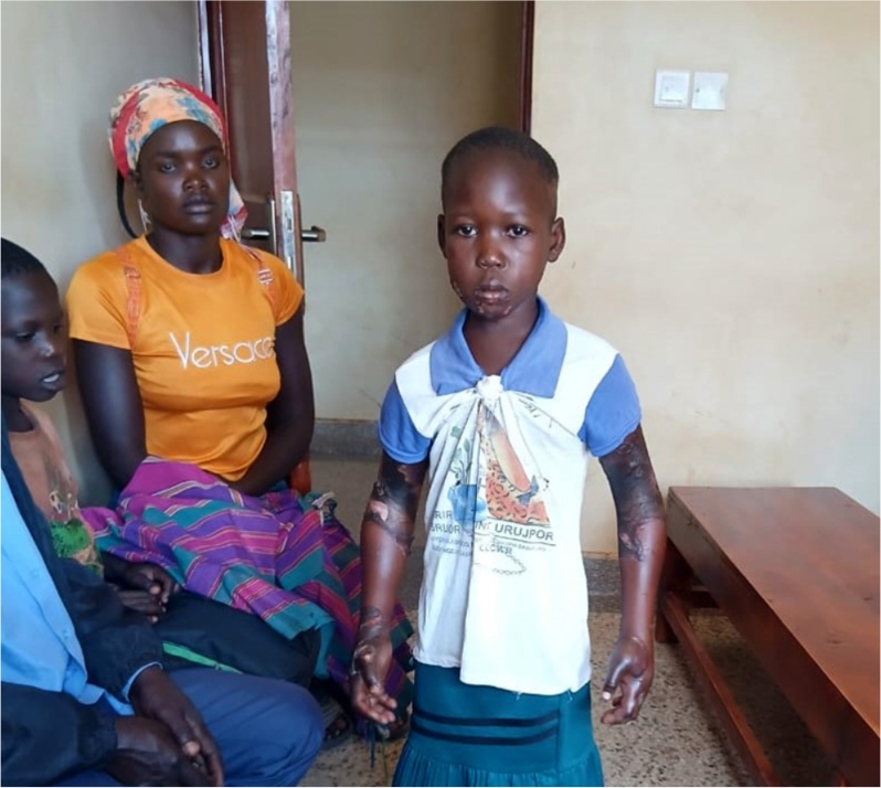 Namayingo Woman Remanded for Setting Granddaughter on Fire Over Mukene Theft